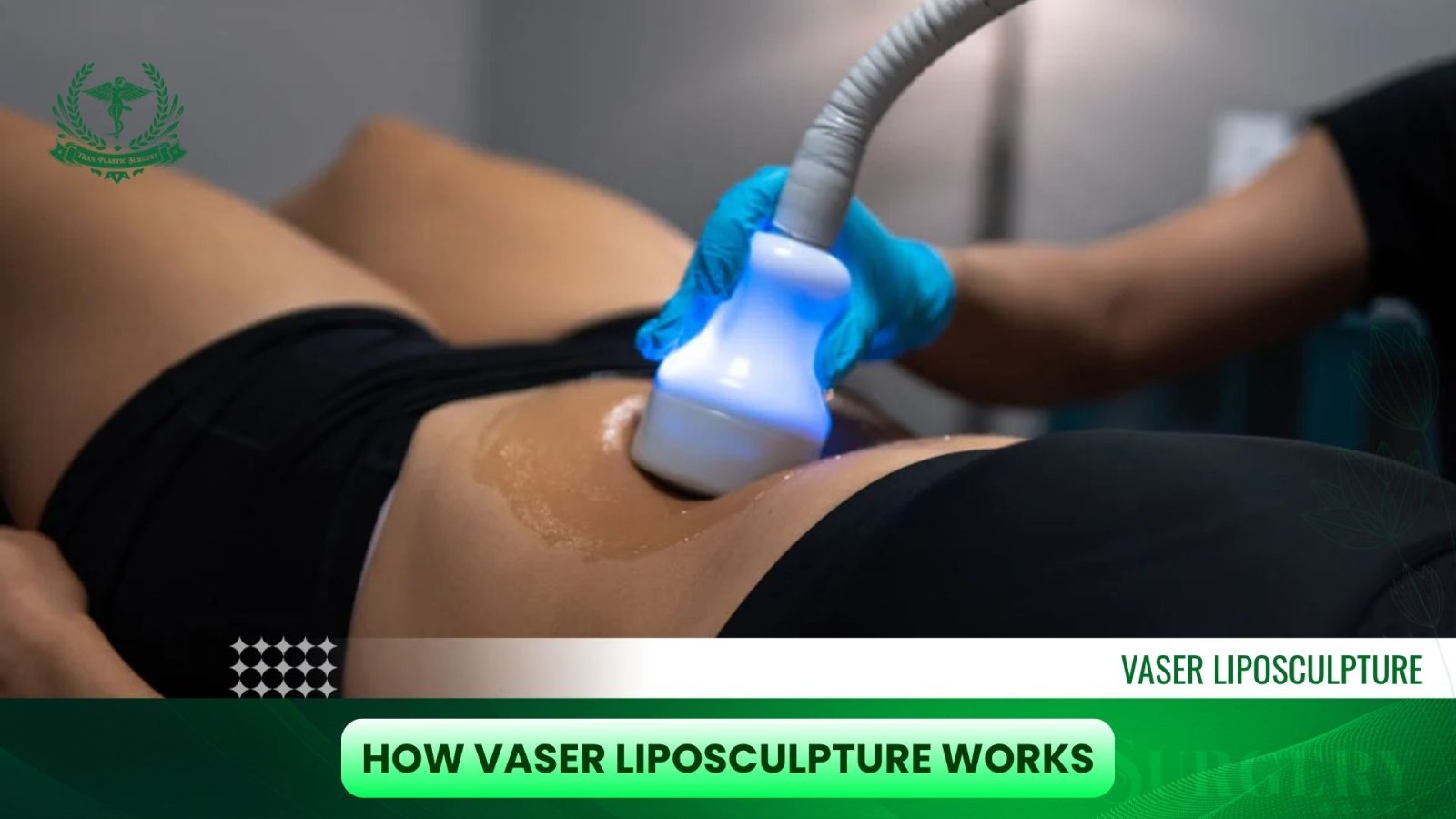 How VASER Liposculpture Works: Precision Body Sculpting