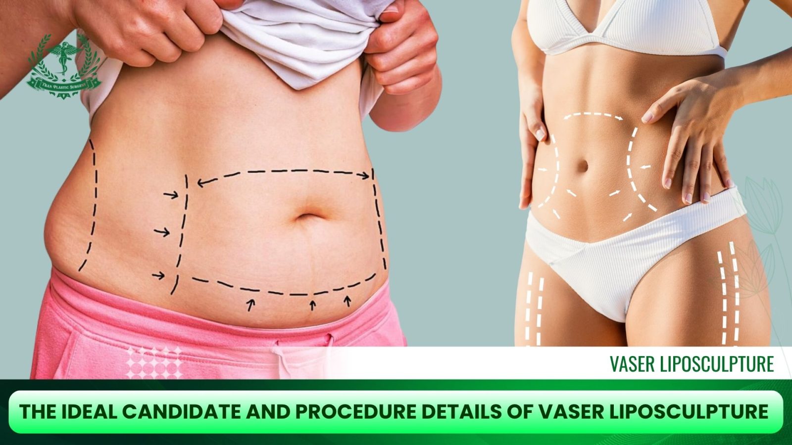 The Ideal Candidate and Procedure Details