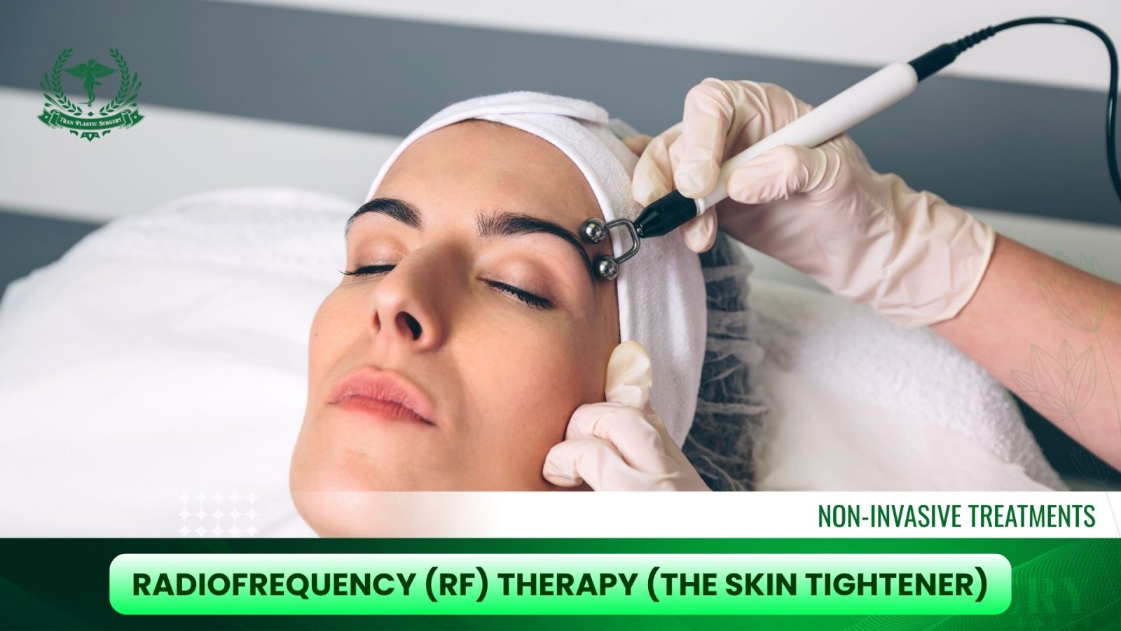 Radiofrequency (RF) Therapy (The Skin Tightener)