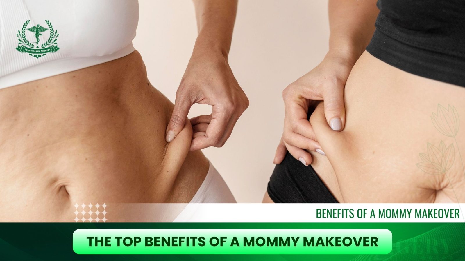 The Top Benefits of a Mommy Makeover