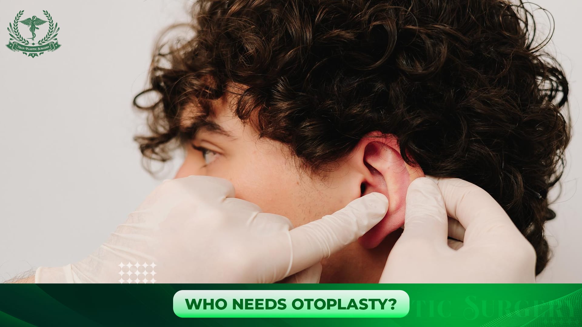 Who Needs Otoplasty?