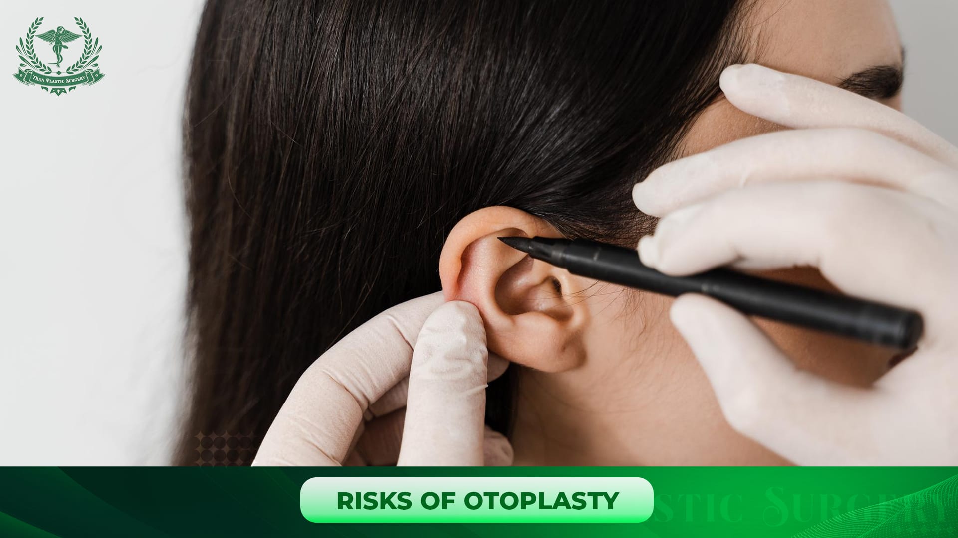Risks of Otoplasty