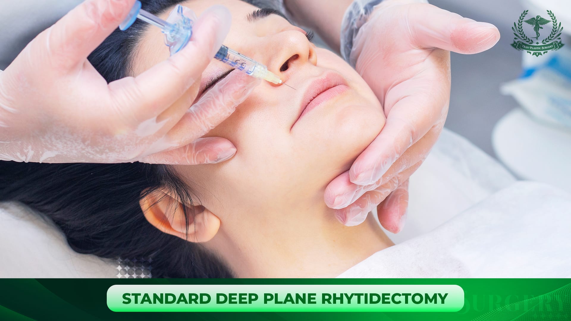 STANDARD DEEP PLANE RHYTIDECTOMY