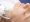 Radiofrequency Microneedling
