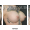 Breast Lift Service at Tran Plastic Surgery