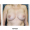 Breast Lift Service at Tran Plastic Surgery