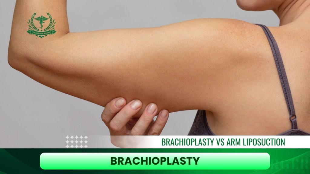 Brachioplasty: The Definitive Solution for Sagging Arm Skin