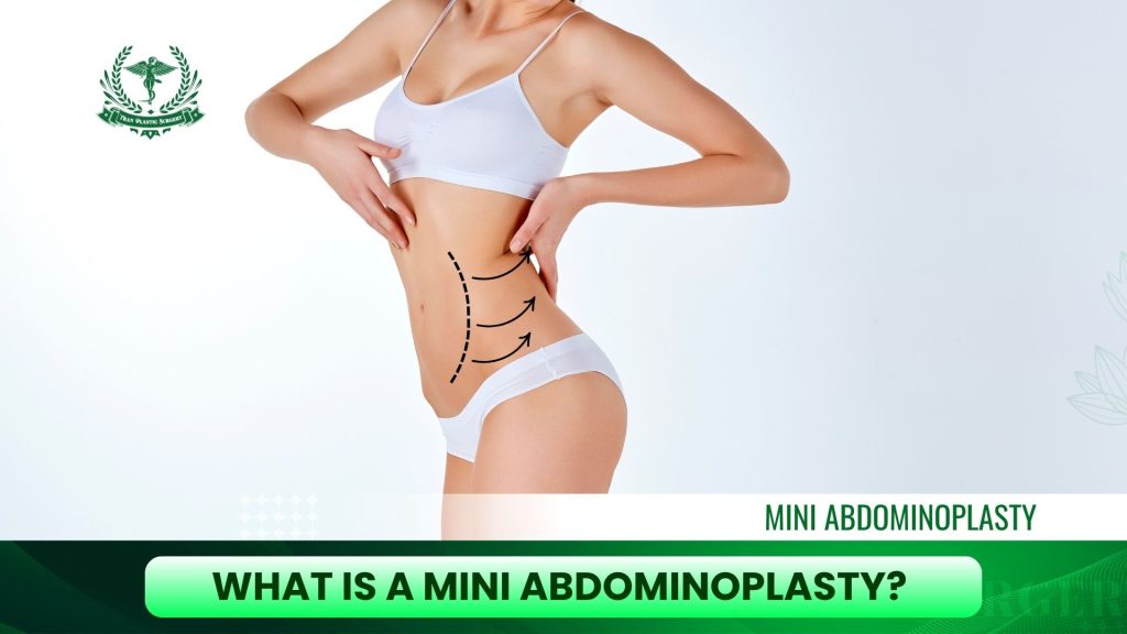What is a Mini Abdominoplasty?