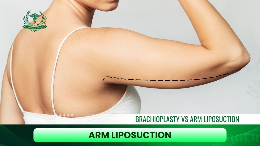 Arm Liposuction: Targeted Fat Removal for Slimmer, Sculpted Arms