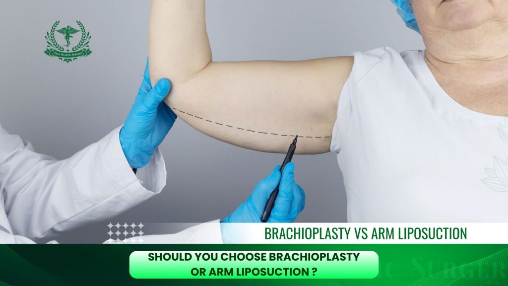 Should You Choose Brachioplasty or Arm Liposuction