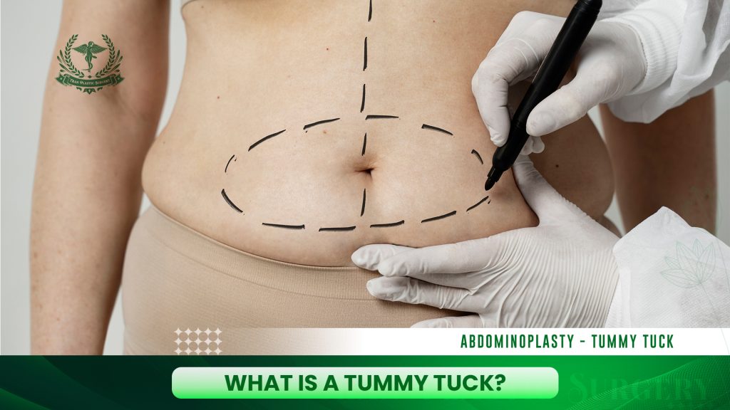 What is a Tummy Tuck?