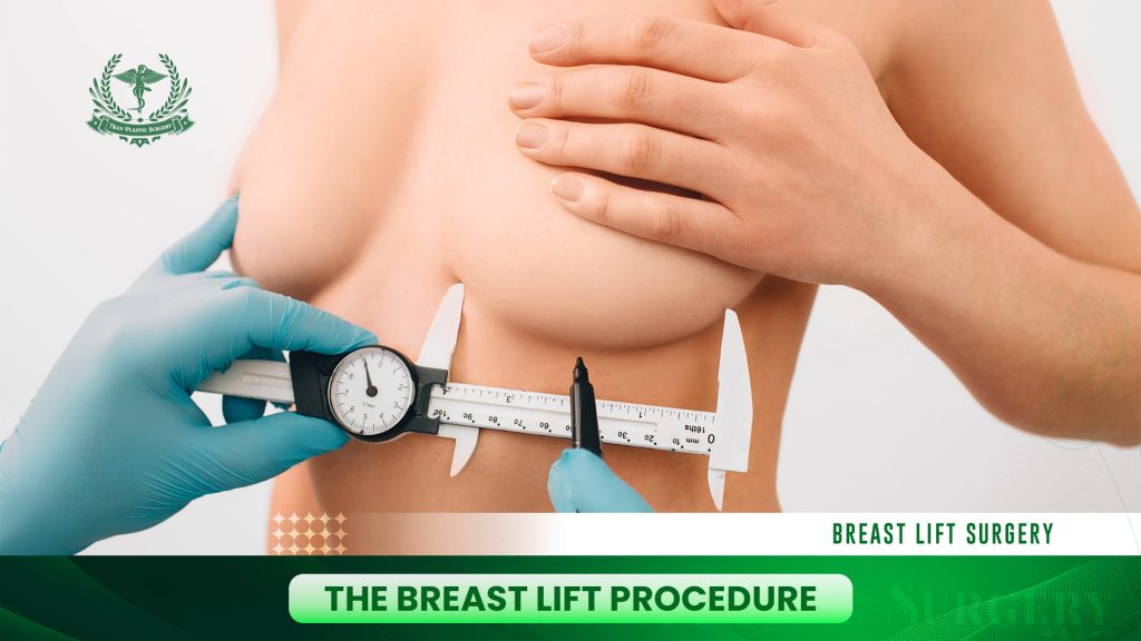 The Breast Lift Procedure