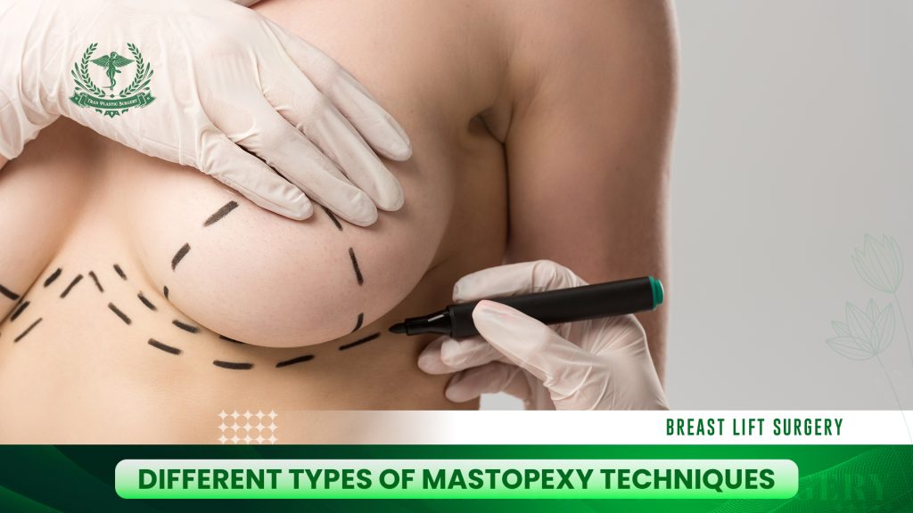 Different Types of Mastopexy Techniques