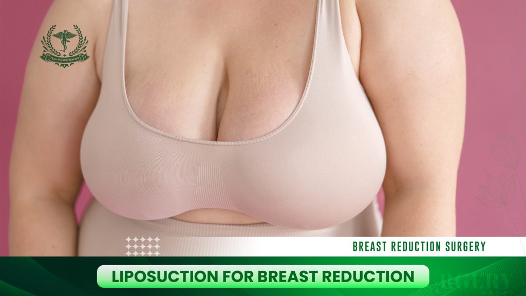 Liposuction for Breast Reduction