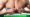 Breast Reduction for Gender Affirmation