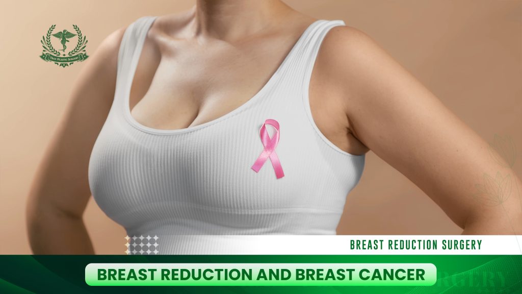 Breast Reduction and Breast Cancer