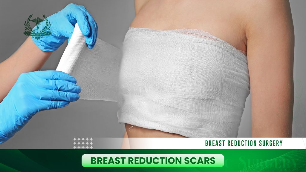 Breast Reduction Scars