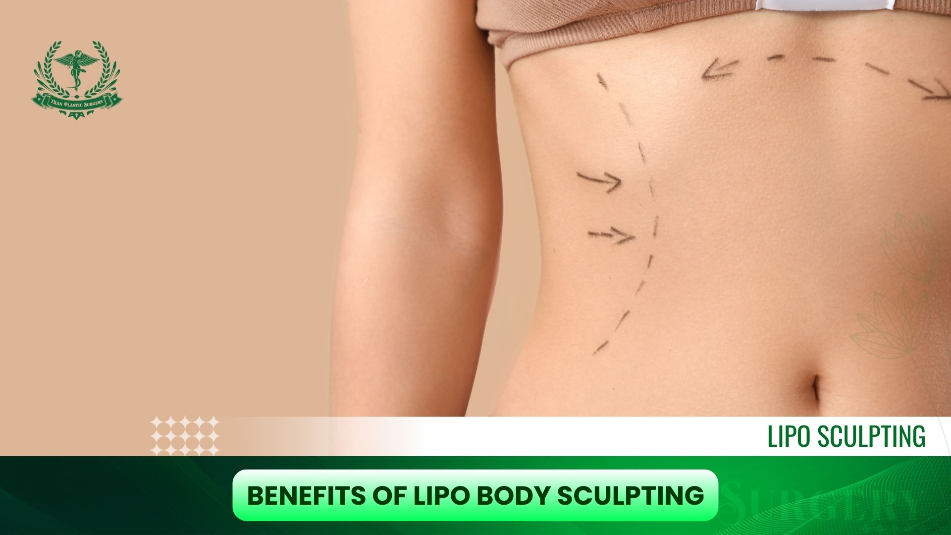 Benefits of Lipo Body Sculpting