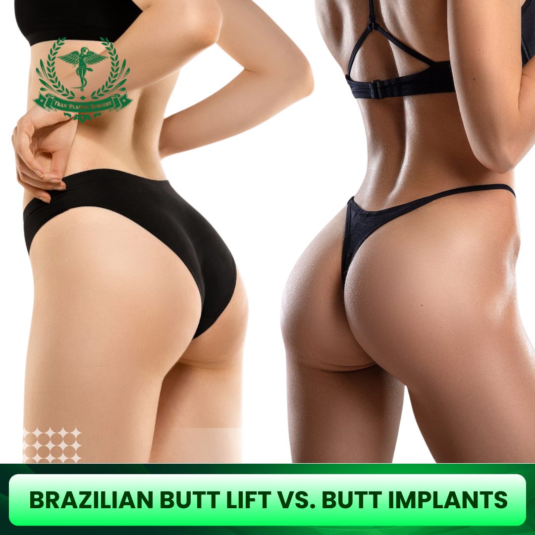 Brazilian Butt Lift vs. Butt Implants