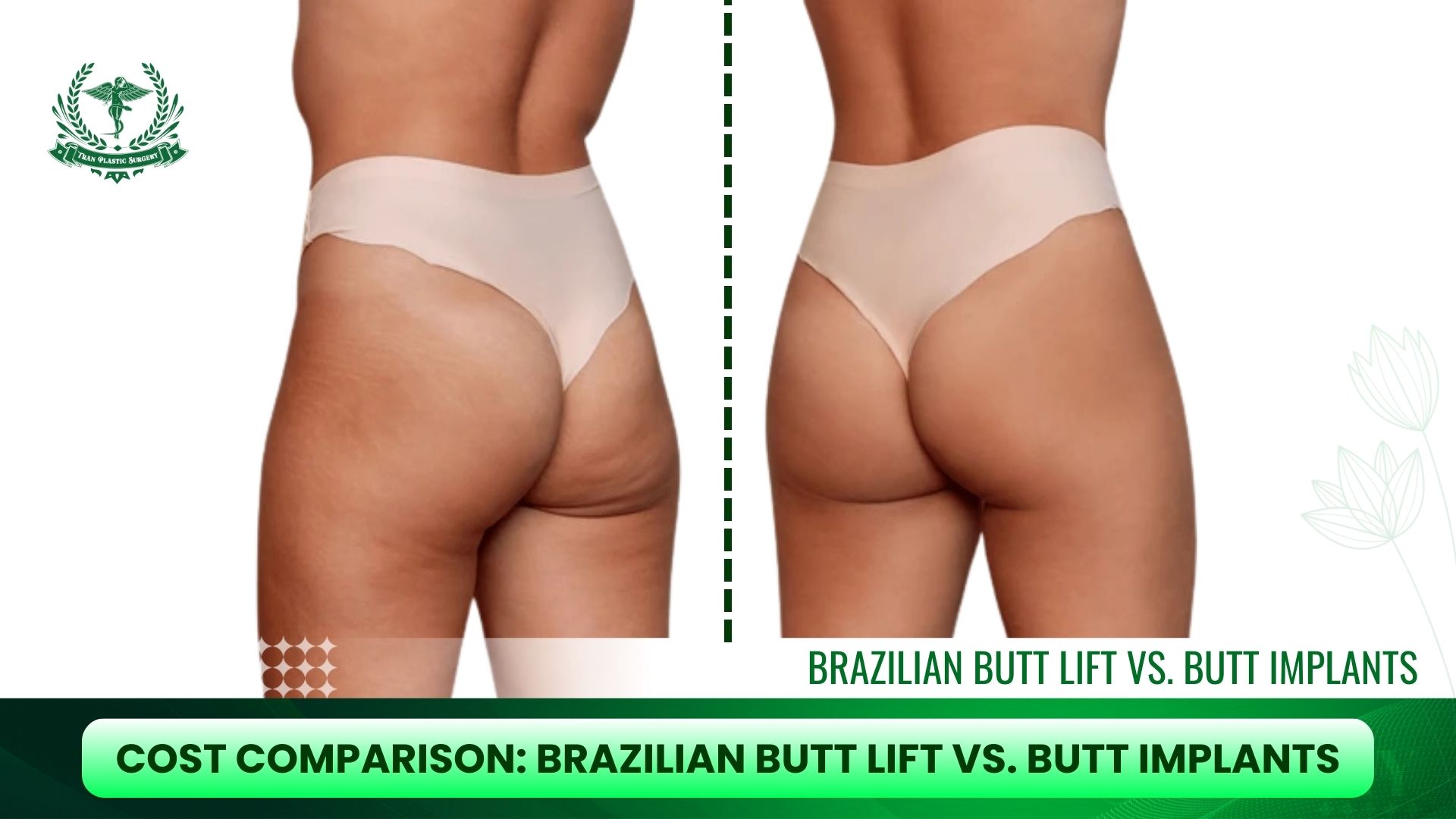 Cost Comparison: Brazilian Butt Lift vs. Butt Implants