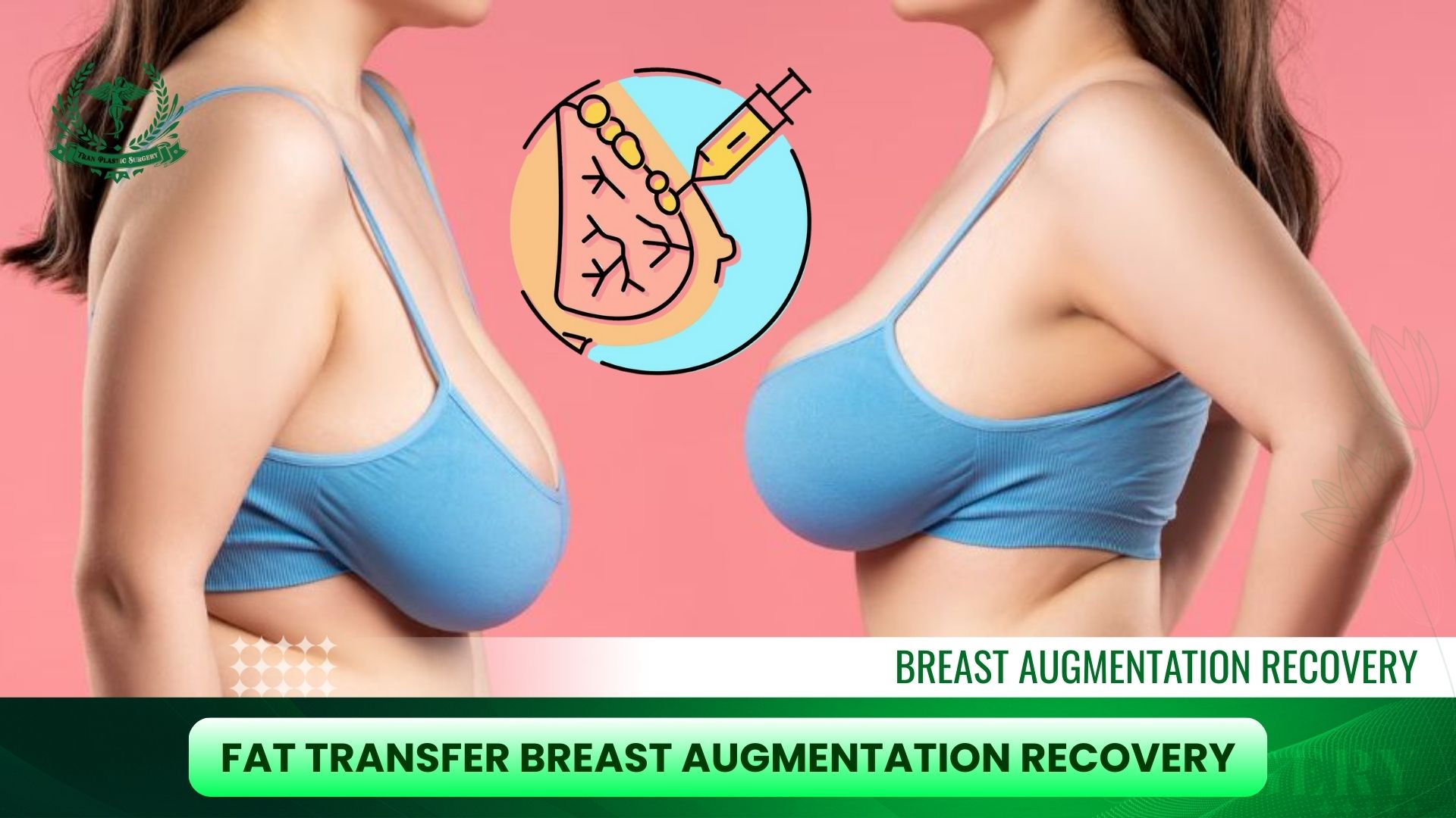 Fat-Transfer Breast Augmentation Recovery