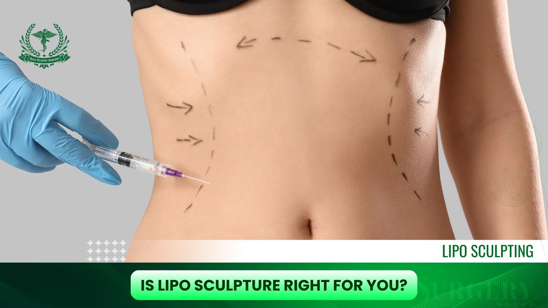 Is Lipo Sculpture Right for You?