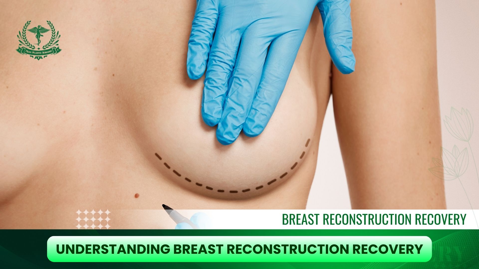 Understanding Breast Reconstruction Recovery