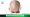 Advantages of FUT Hair Transplant