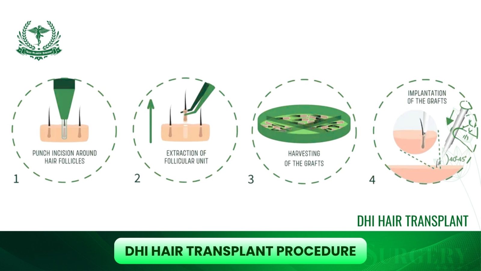 DHI Hair Transplant Procedure