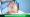 DHI Hair Transplant Recovery & Aftercare