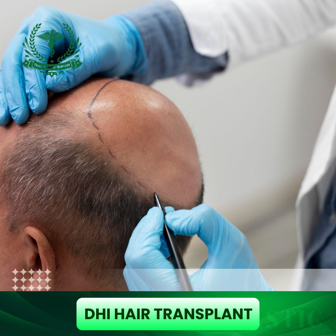 DHI Hair Transplant