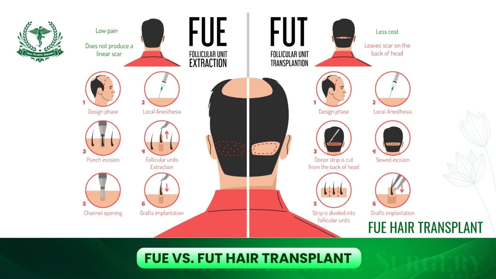 FUE vs. FUT Hair Transplant