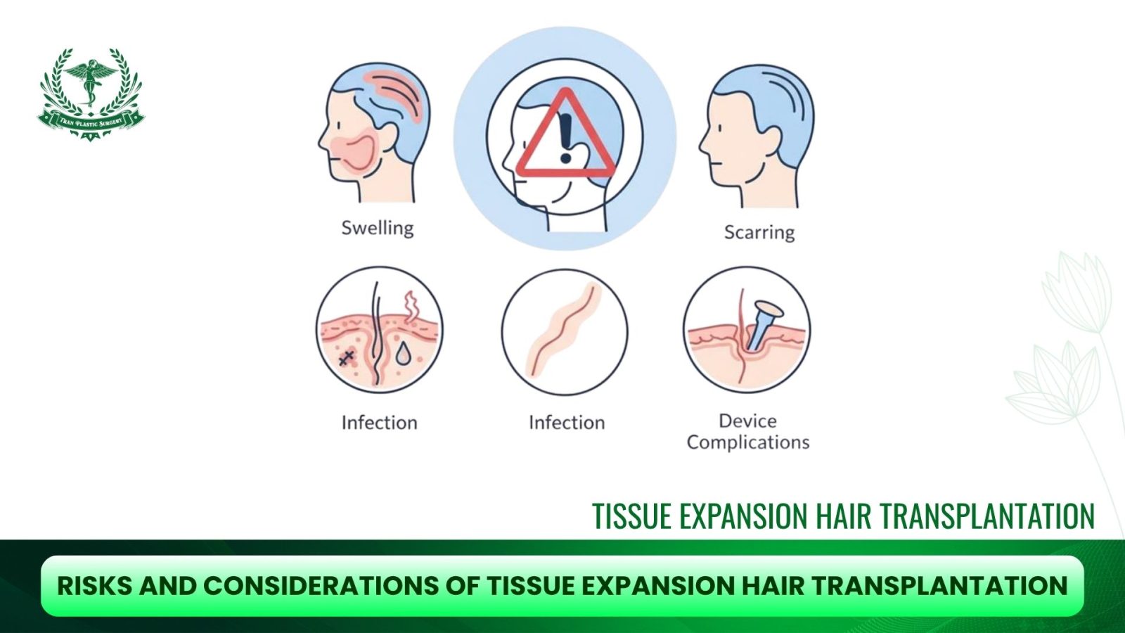 Risks and Considerations of Tissue Expansion Hair Transplantation