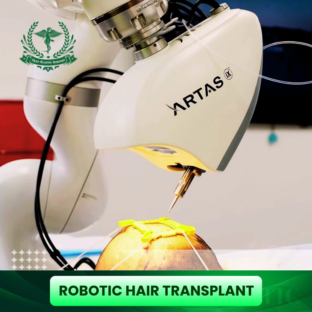 Robotic Hair Transplant