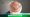 What Is FUE Hair Transplant?