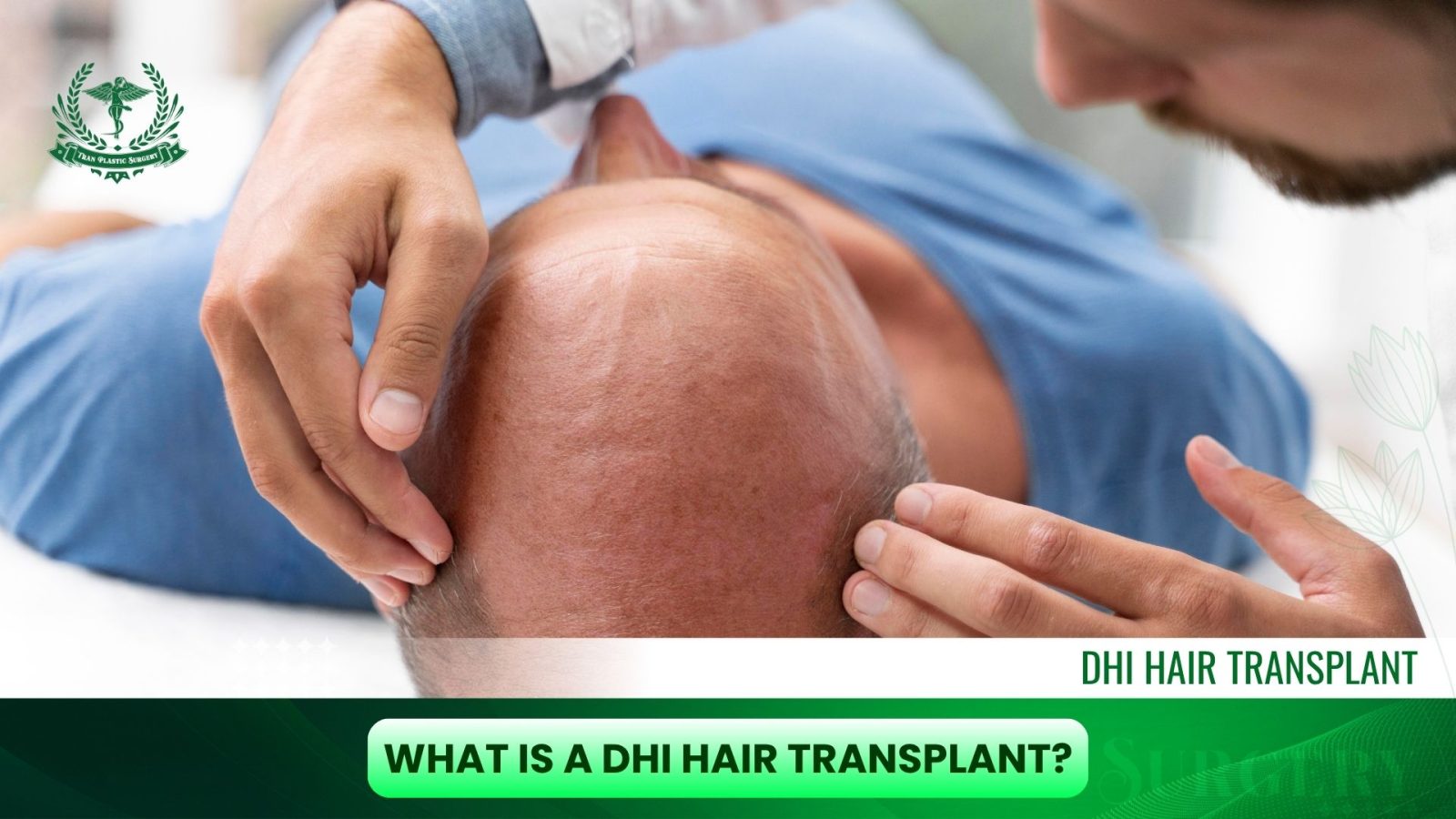 What Is a DHI Hair Transplant?