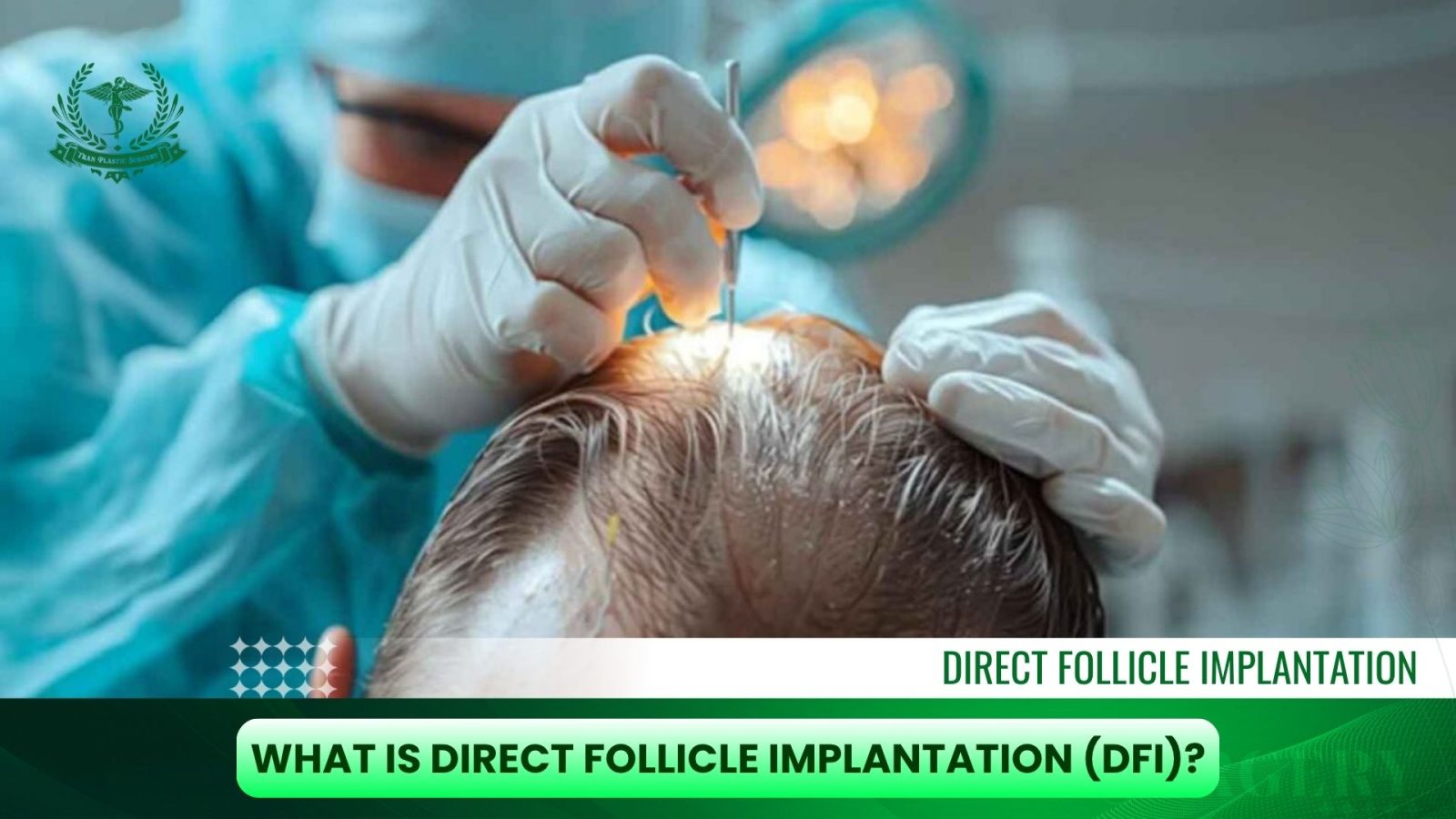 What is Direct Follicle Implantation (DFI)
