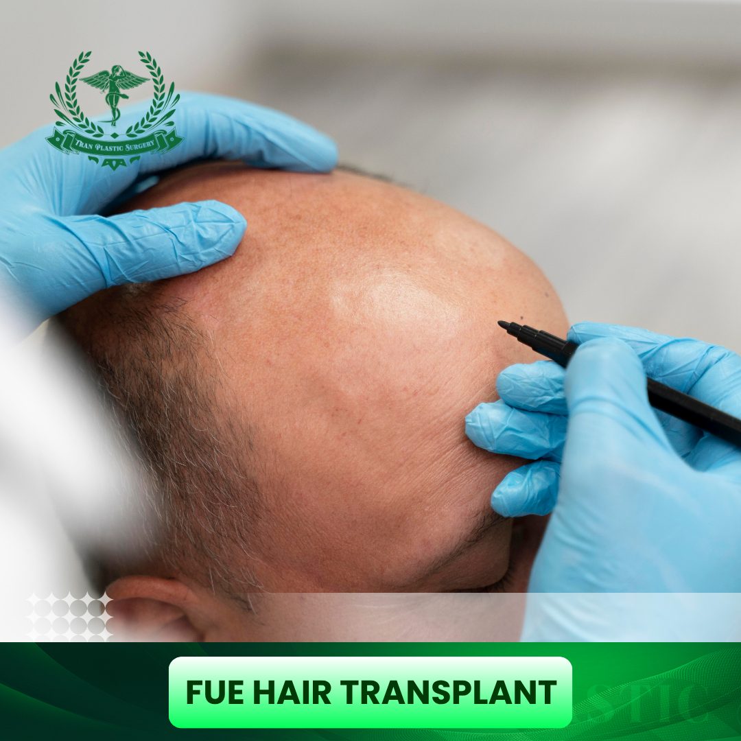 fue hair transplant