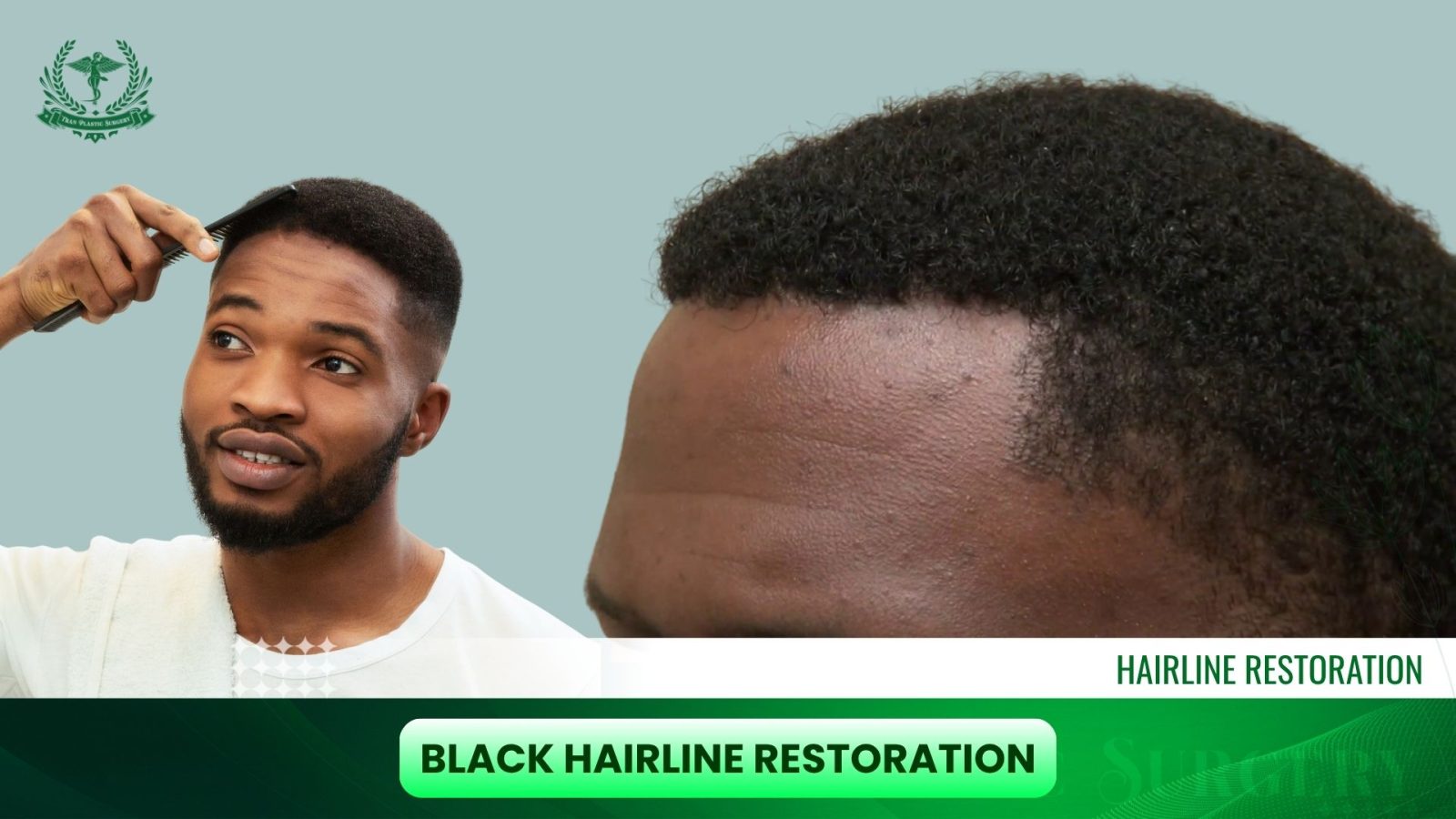 Black Hairline Restoration