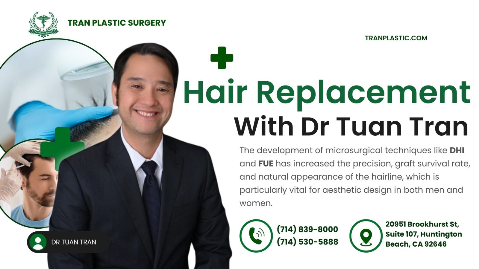 Hair Replacement with Dr Tuan Tran (Tran Plastic Surgery in California)