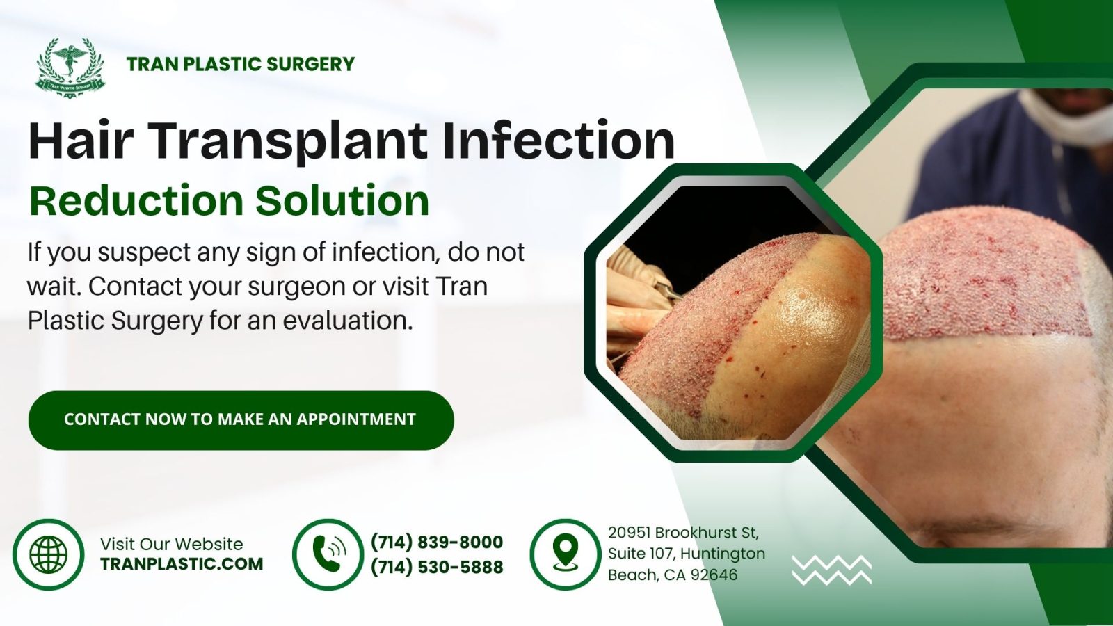 Hair Transplant Infection - Tran Plastic Surgery