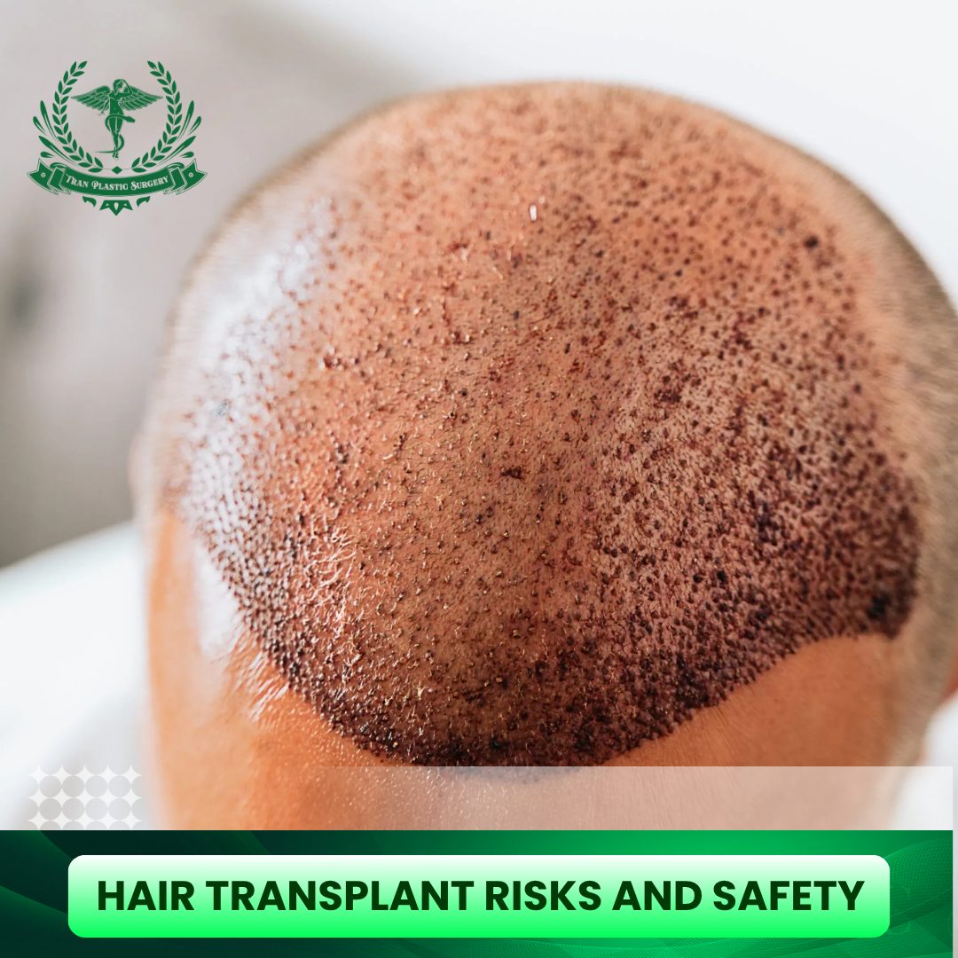 Hair Transplant Risks and Safety