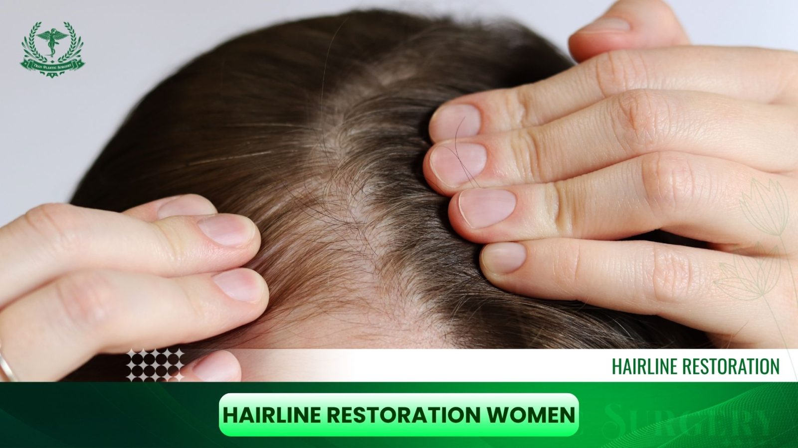 Hairline Restoration Women
