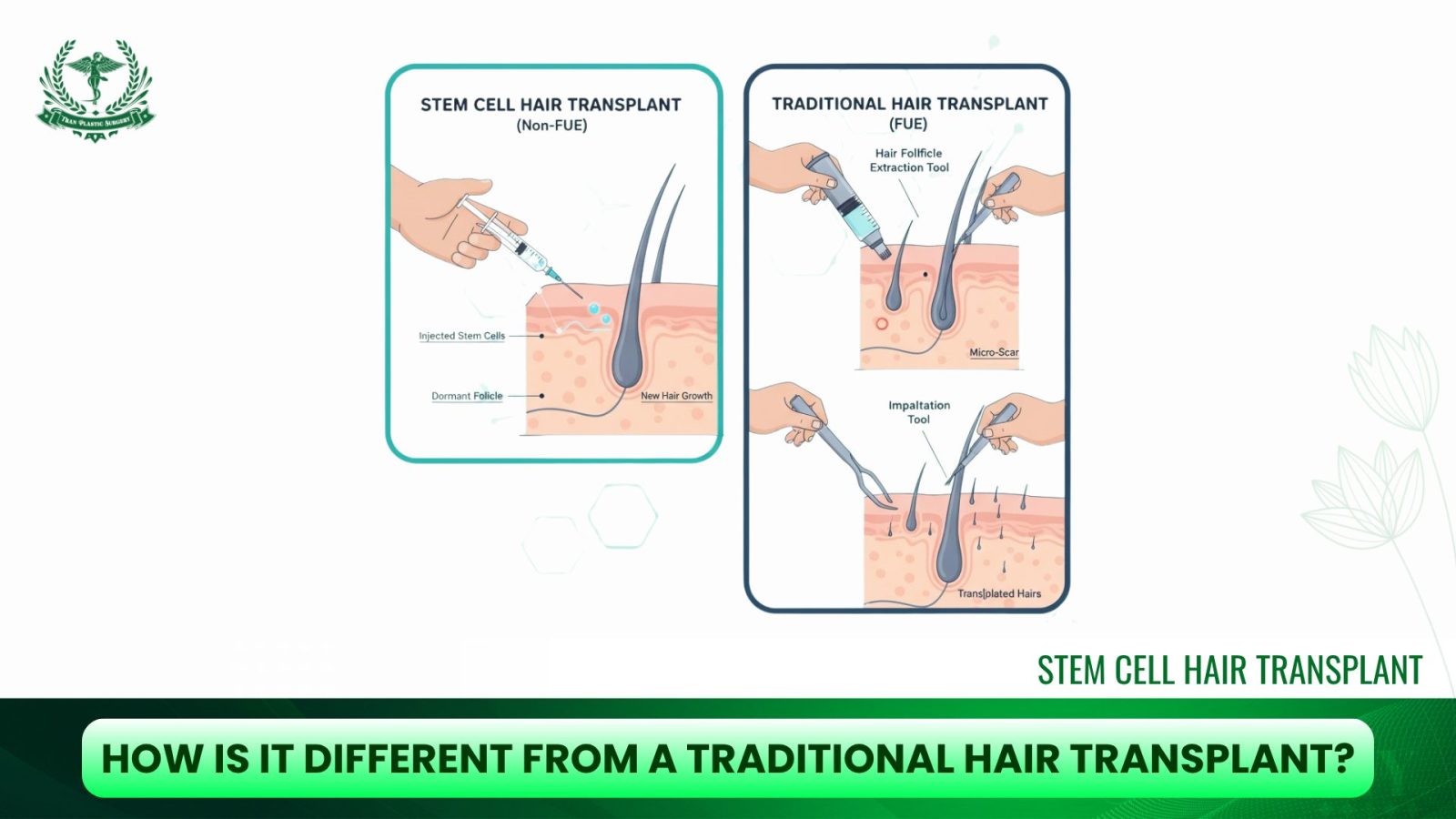 How Is It Different from a Traditional Hair Transplant?