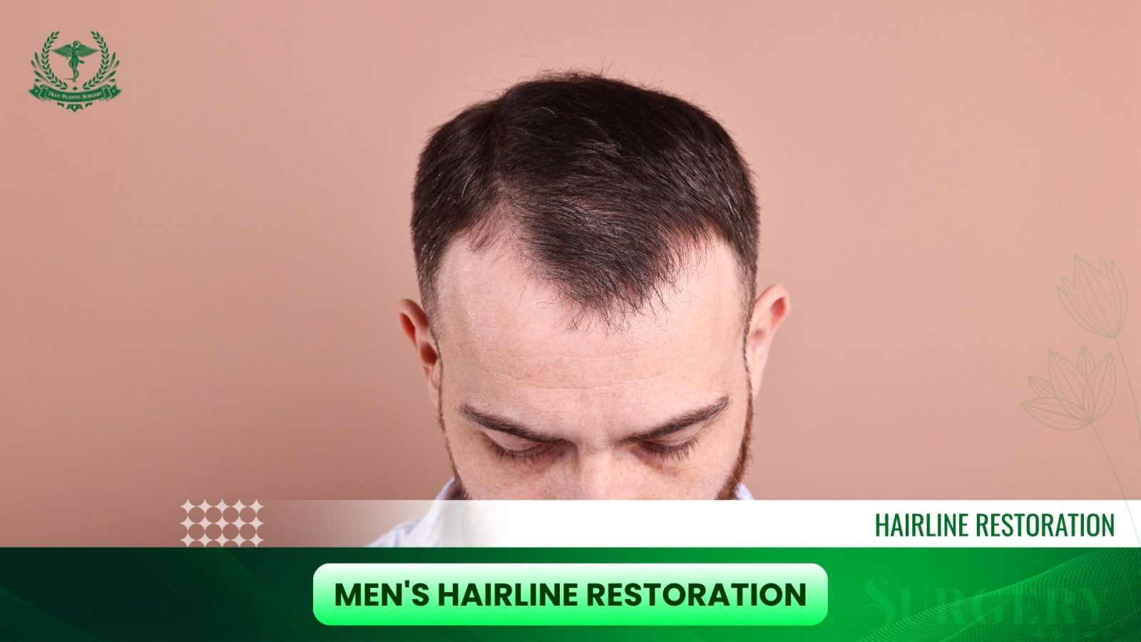 Men's Hairline Restoration