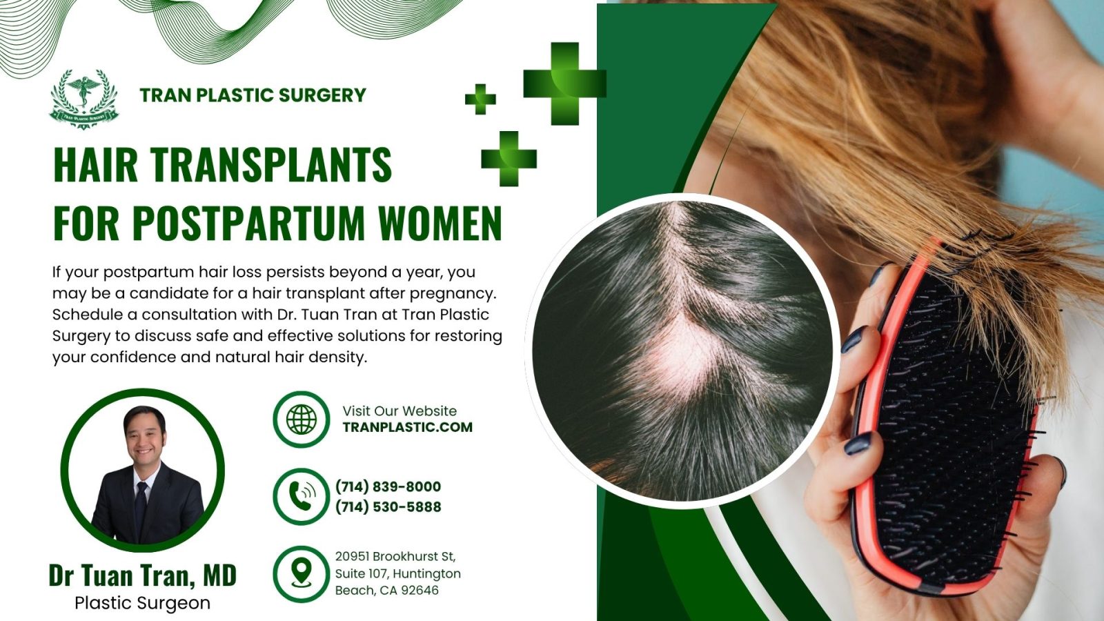 Postpartum Hair Loss - Tran Plastic Surgery