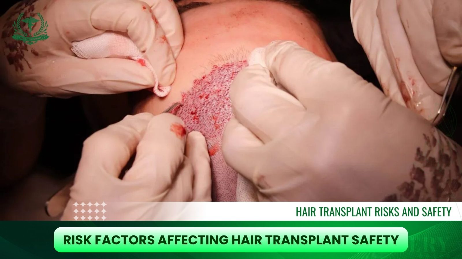 Risk Factors Affecting Hair Transplant Safety