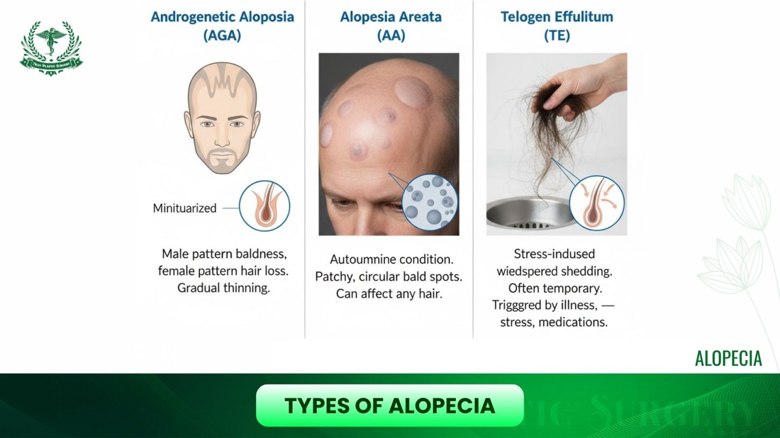 Types of Alopecia