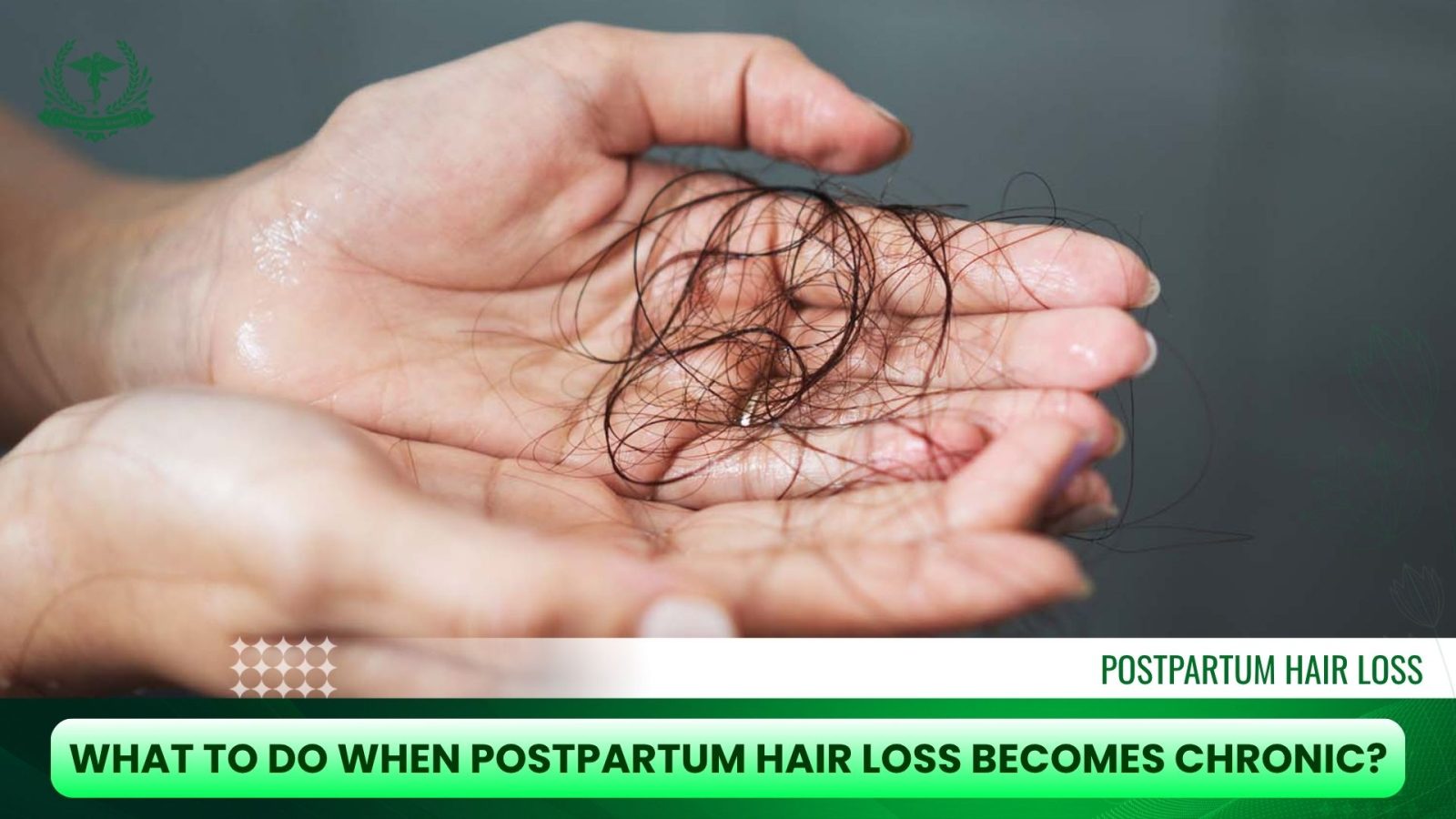 What To Do When Postpartum Hair Loss Becomes Chronic?