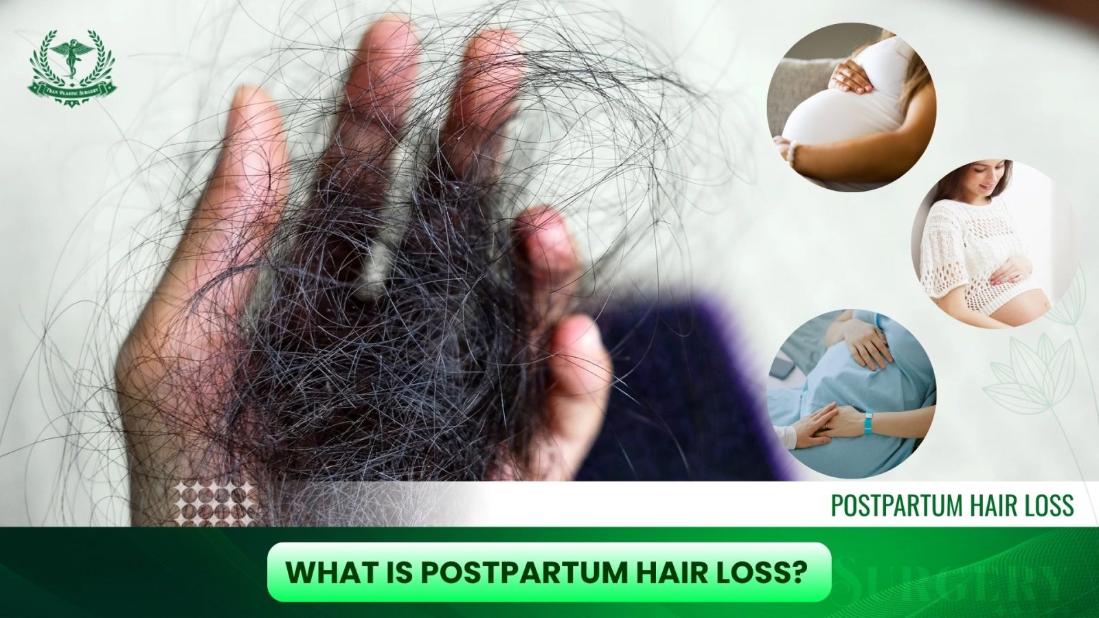 What is Postpartum Hair Loss